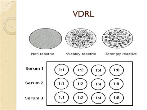 vdrl test sensitivity